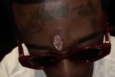 Lil Uzi Vert Removes $24 Million Diamond From His Forehead
