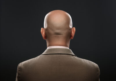 Judge Rules Calling Men 'Bald' Is Sexual Harassment